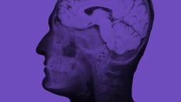 Side view X-ray image of a human head and brain in shades of purple, shown against a solid purple background, highlighting the serene focus often seen in meditators.