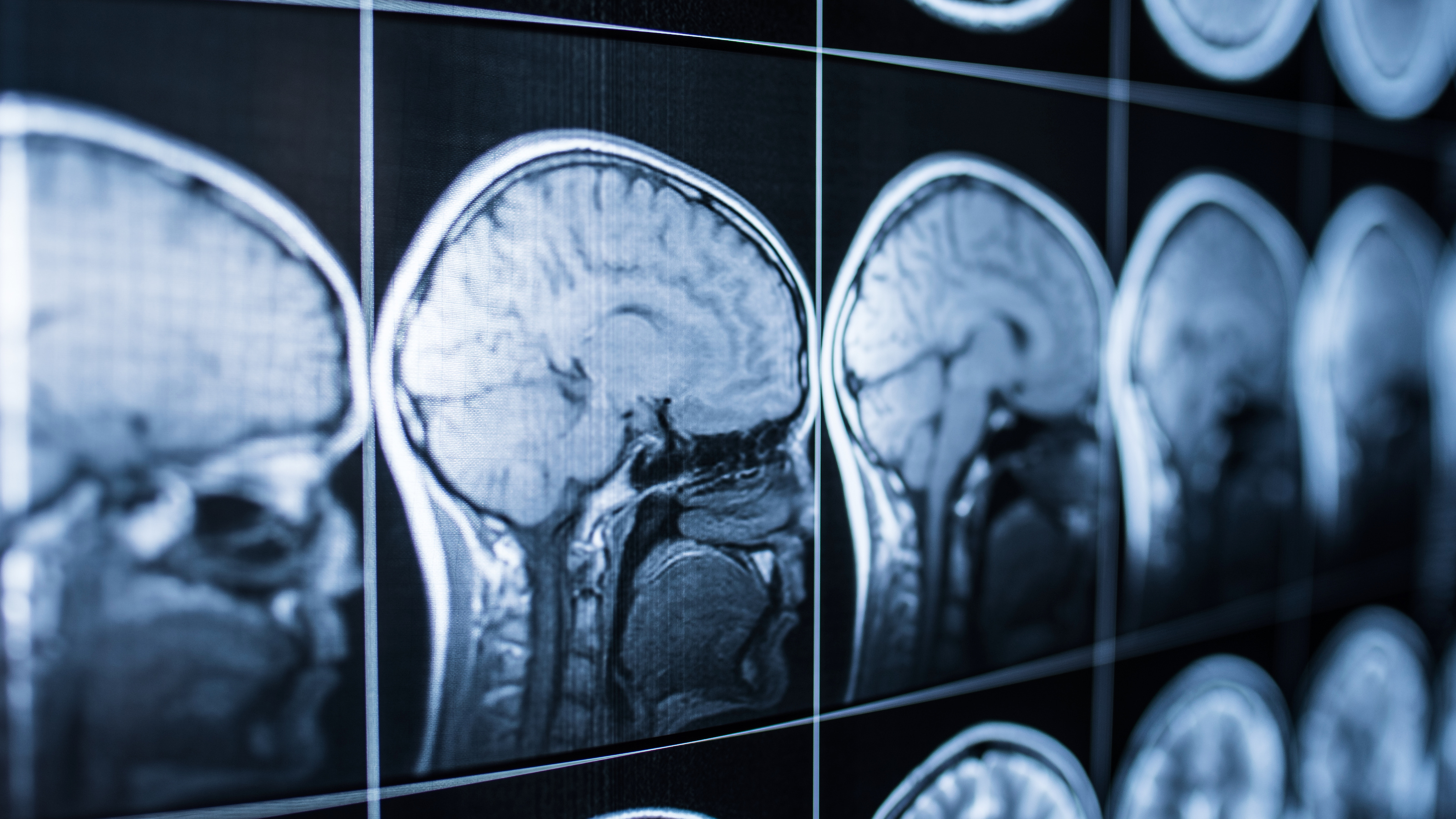 Brain scans