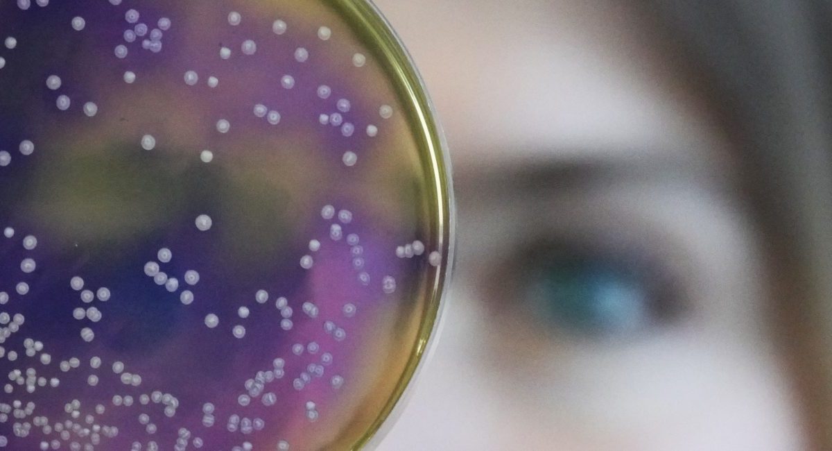 yeast cell colony humans