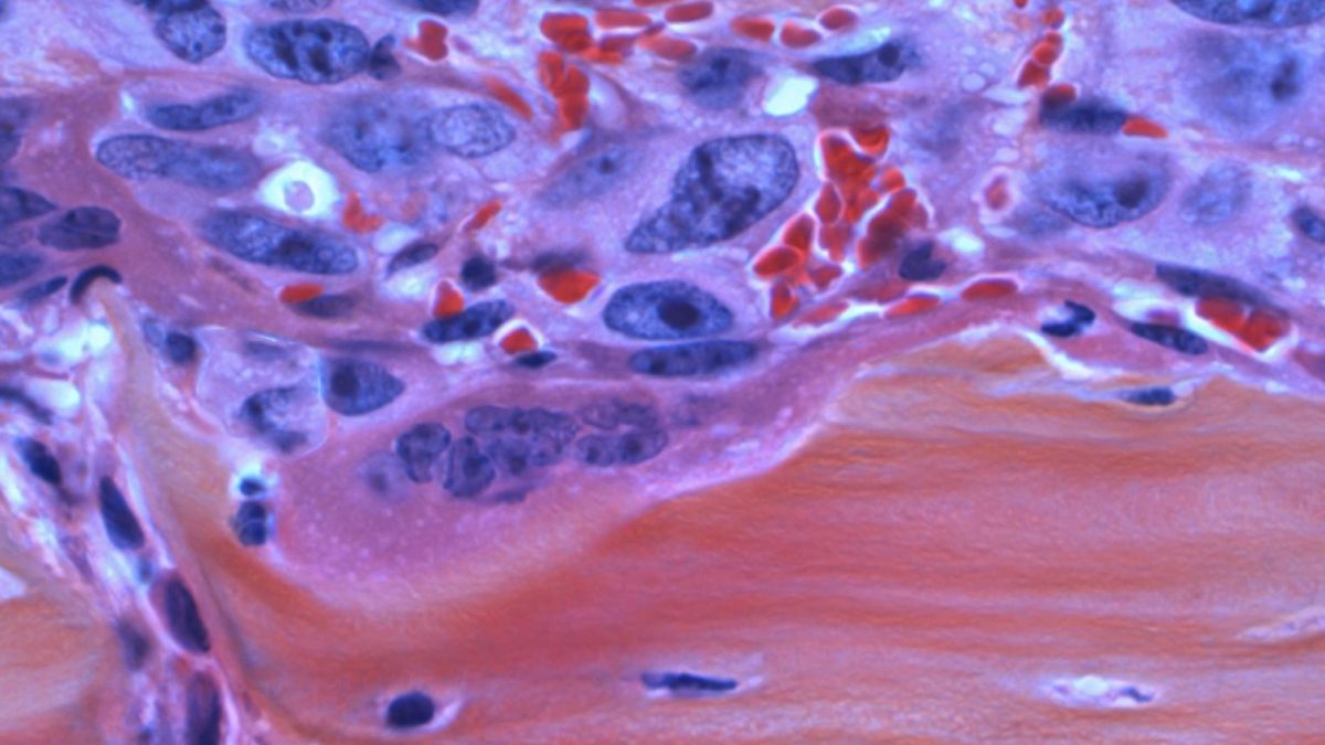 a close up of a piece of skin.