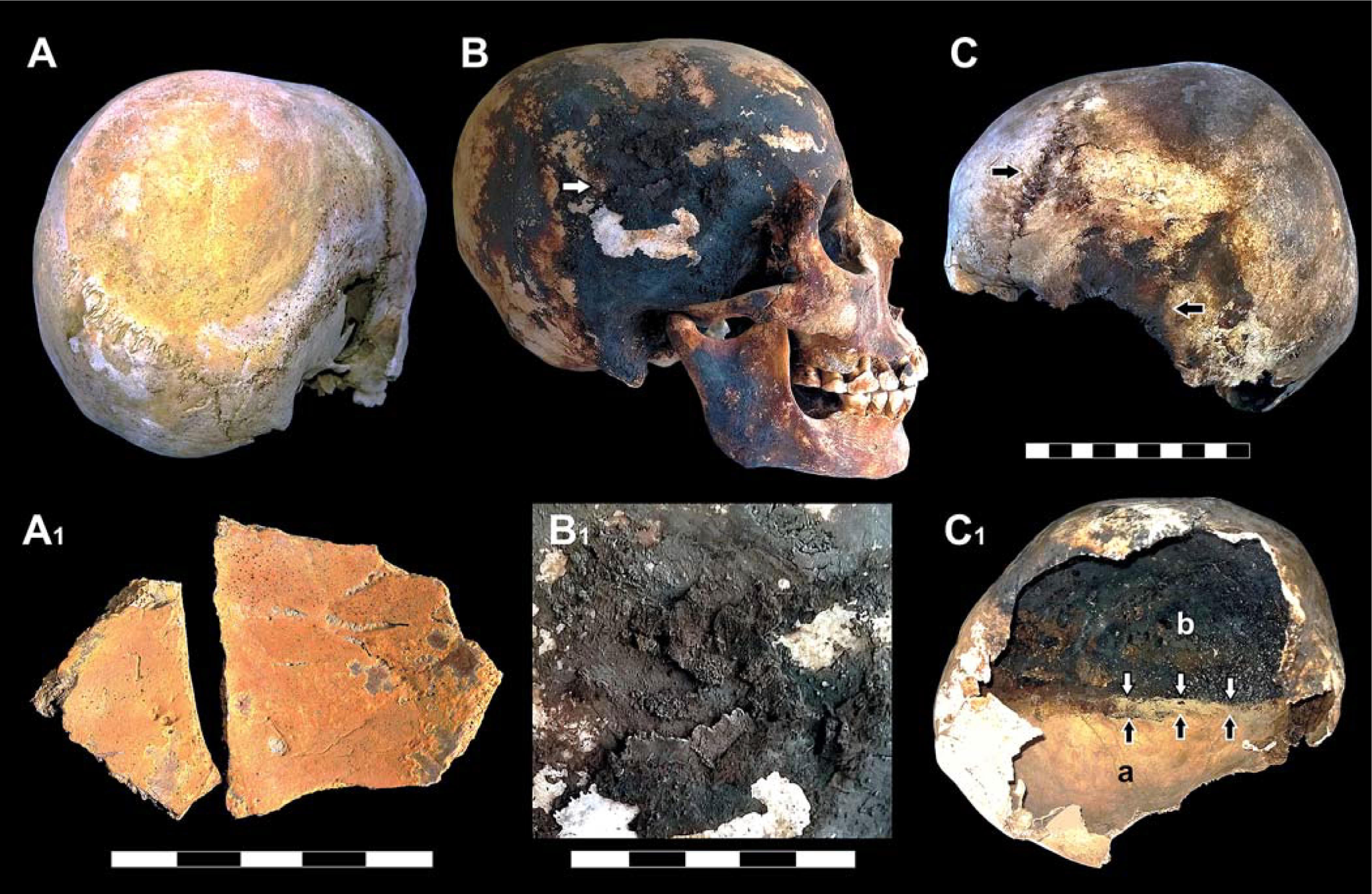 Herculaneum skull with red and black mineral deposits