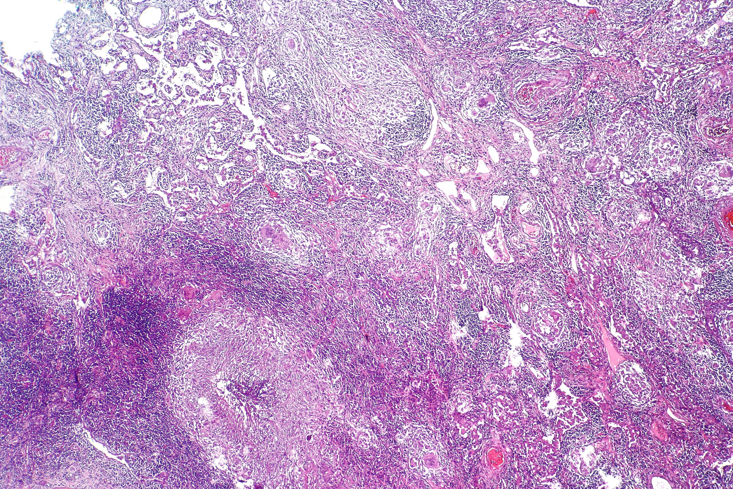 Microscopic view of tissue stained with hematoxylin and eosin, showing various cell structures and connective tissue in shades of pink and purple.