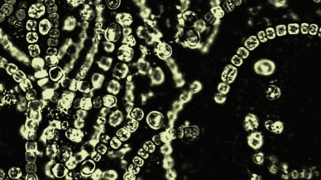 Microscopic view of green cyanobacteria chains forming spiral and linear patterns against a dark background, highlighting their role within the microbiome.