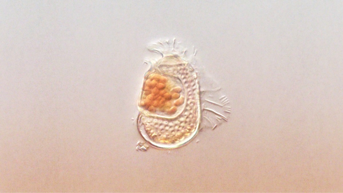 Microscopic view of a single-celled organism with a translucent body and clustered orange structures inside, set against a plain background.